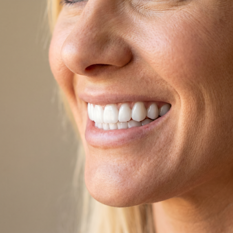Uśmiech po założeniu nakładki Snap-On-Smile